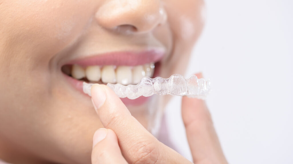 Young smiling woman holding invisalign braces over white